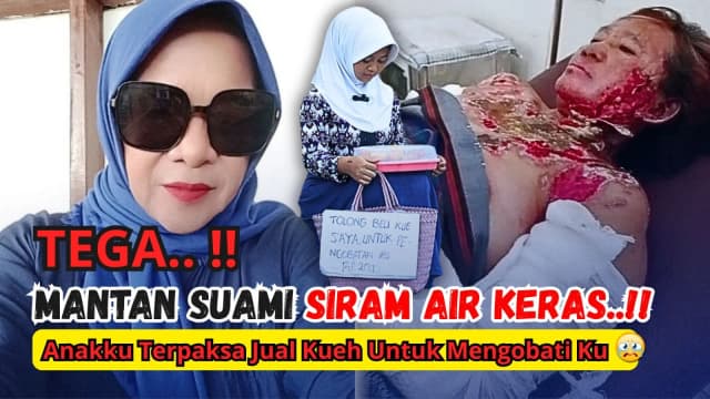Bantu Pengobatan Bu Sani Yang Di Siram Air Keras Oleh Mantan Suaminya